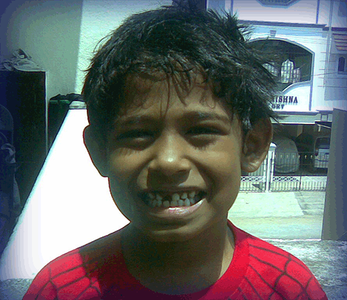 My 1st Teeth Gone